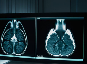 Donald Trump promite să publice rezultatele RMN-ului său, pe fondul lipsei de detalii